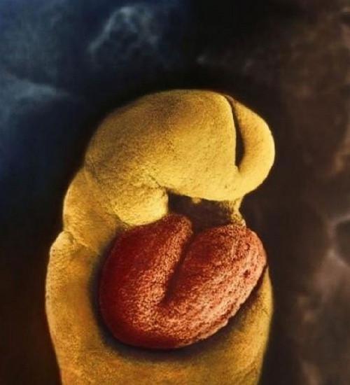 移植第八天胚胎图片图片